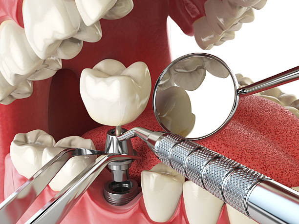 Best Walk-In Emergency Dentist in Houston, MS