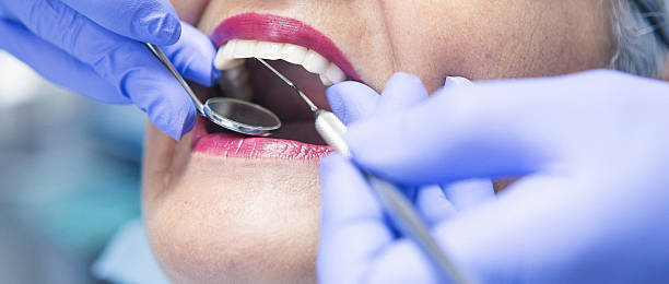 Best Emergency Root Canal Treatment in Houston, MS